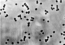 Khuẩn Nitrosomonas