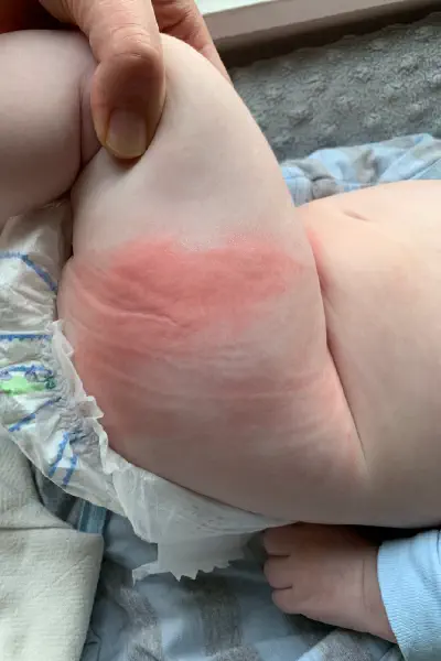 Trẻ nhỏ rất nhạy cảm với amoni