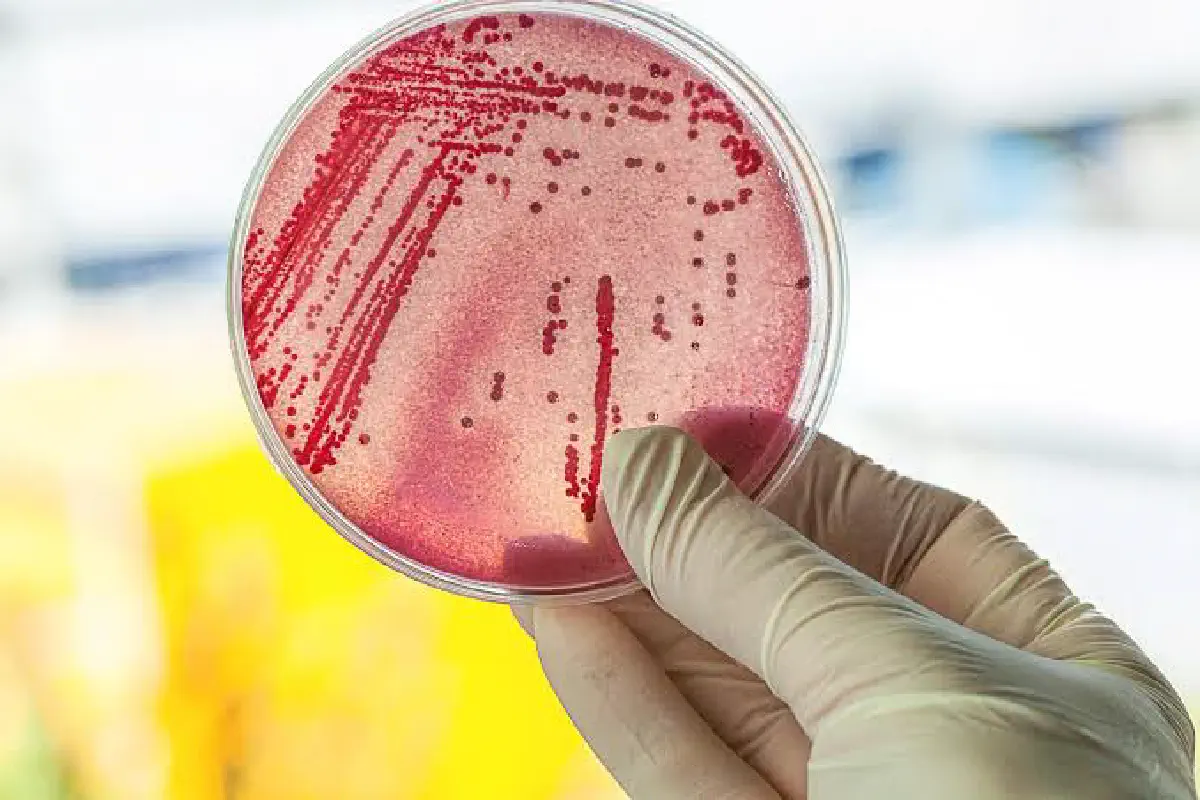 Vi khuẩn E.coli trong nước uống: Dấu hiệu ô nhiễm phân nguy hiểm cần loại bỏ hoàn toàn